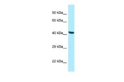 PANK2 Antibody, Novus Biologicals 100 &mu;L; Unconjugated:Antibodies, Polyclonal